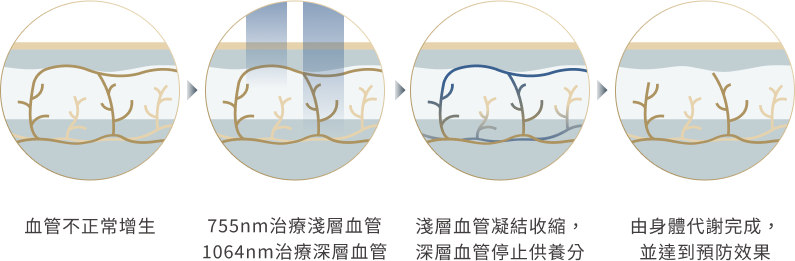 除紅原理